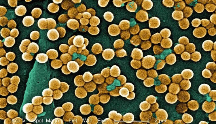uchenye-vystupili-s-preduprezhdeniem-iz-za-superbakterij-8a5ceca